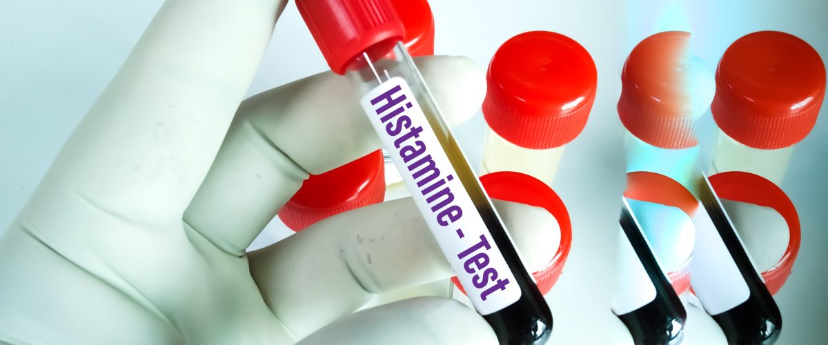 Blood,Sample,For,Tryptase,Test.,A,Tryptase,Test,Can,Help